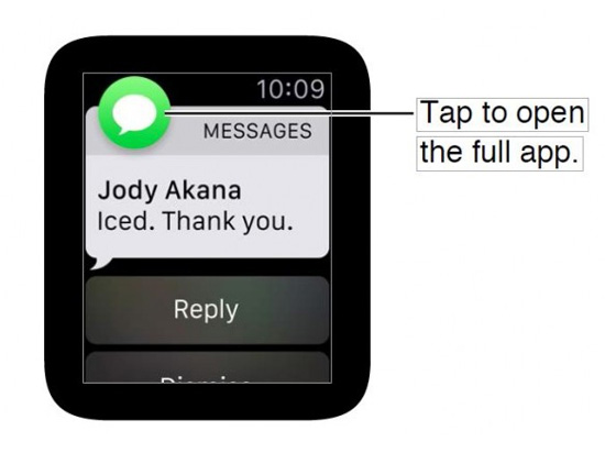 蘋果也耍流氓？Apple Watch首次遭到起訴